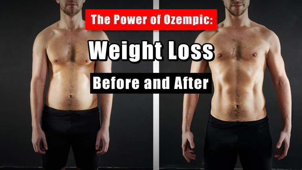 The Power of Ozempic: Weight Loss Before and After
