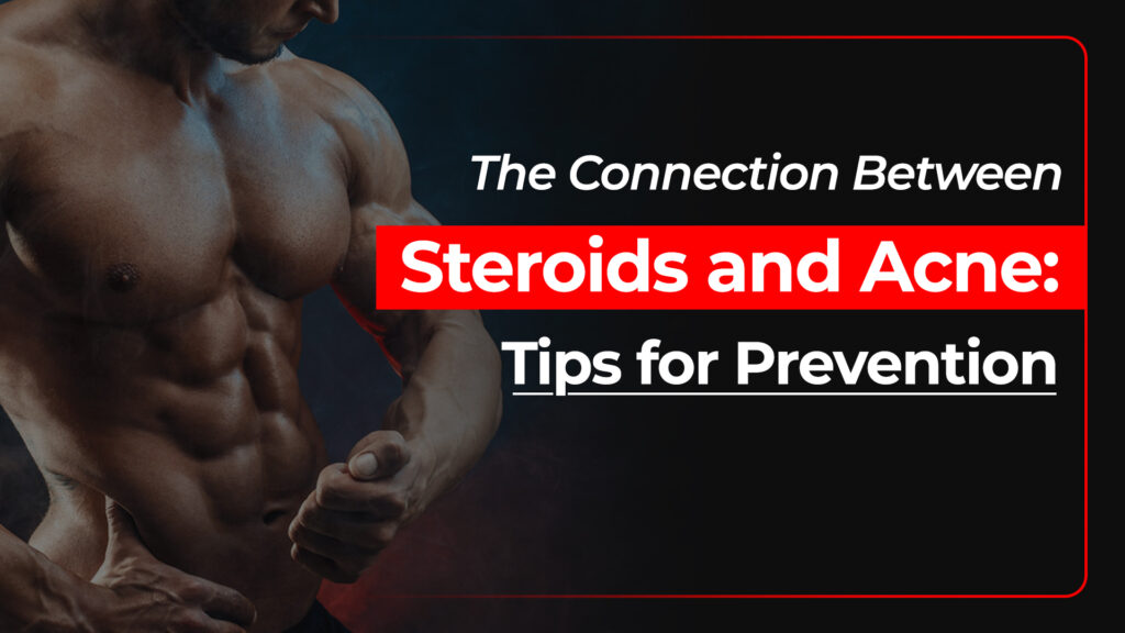 Steroids and Acne Prevention
